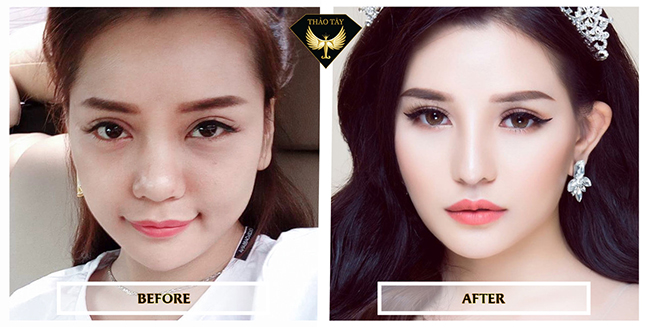 Hotgirl ngực khủng Mon 2K không ngần ngại thừa nhận phẩu thuật thẩm mỹ